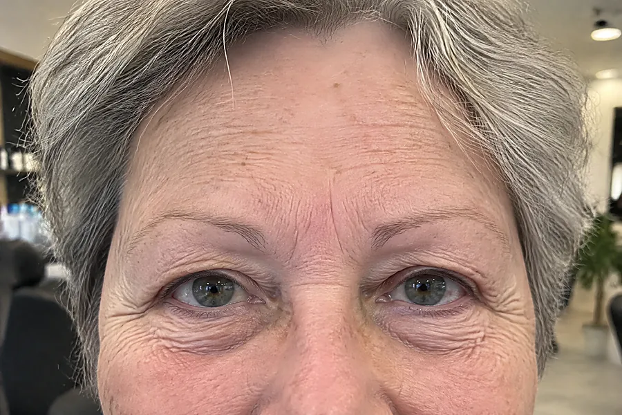Hybrid brows: voor de behandeling (voorbeeldbeeld)